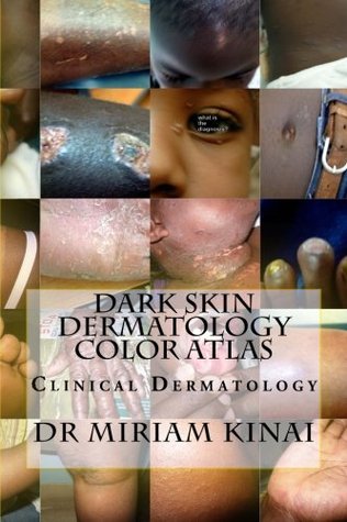 Read Dark Skin Dermatology Color Atlas: Clinical Dermatology (Volume 1) - Miriam Kinai file in ePub