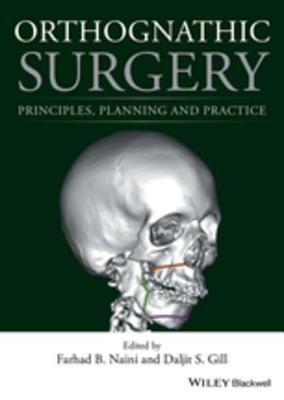 Read Orthognathic Surgery: Principles, Planning and Practice - Farhad B Naini | ePub