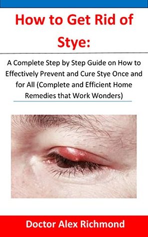 Read Online How to Get Rid of Stye: A Complete Step by Step Guide on How to Effectively Prevent and Cure Stye Once and for All (Complete and Efficient Home Remedies that Work Wonders) - Alex Richmond | ePub