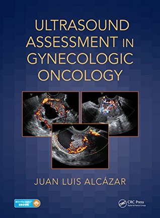 Read Online Ultrasound Assessment in Gynecologic Oncology - Juan Luis Alcazar file in ePub